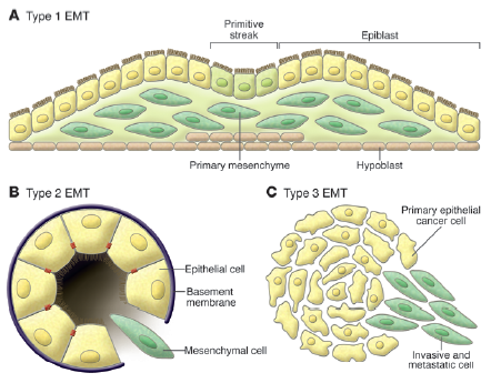 EMT上皮-间质细胞转化三种类型