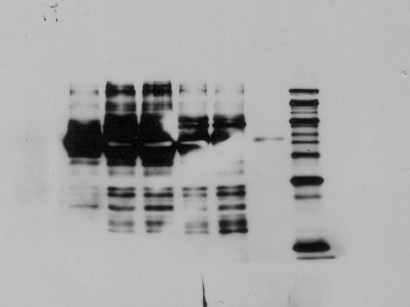 Read more about the article Western Blot 常见问题分析（二）