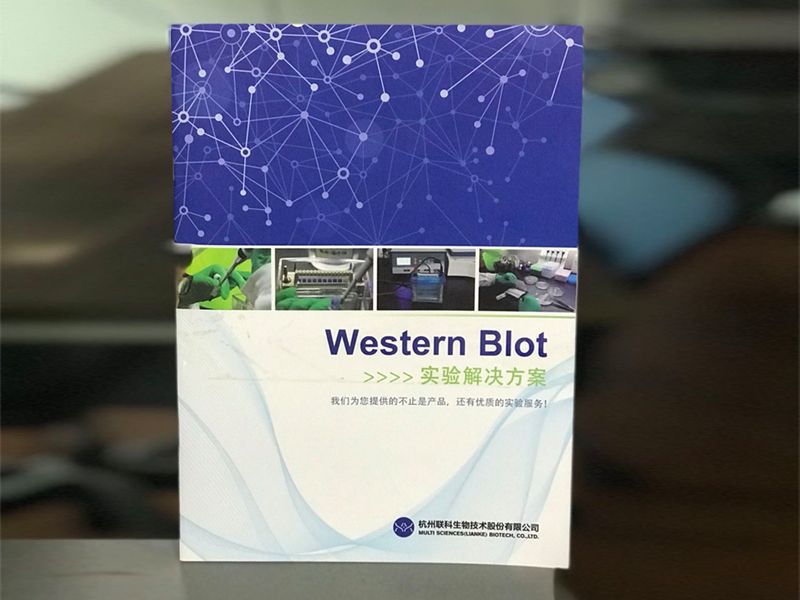 Read more about the article Western Blot 实验解决方案2020版已上线